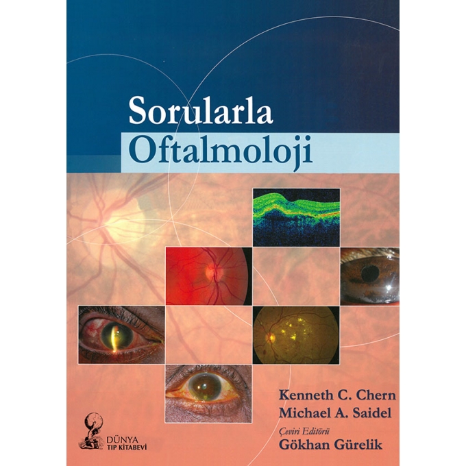 Sorularla Oftalmoloji