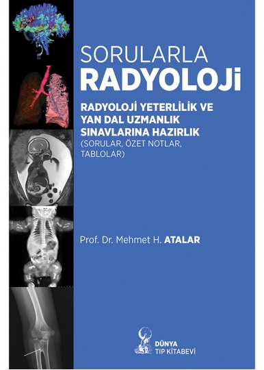 Sorularla Radyoloji: Radyoloji Yeterlilik ve Yan Dal Uzmanlık Sınavlarına Hazırlık (Sorular, Özel Notlar, Tablolar)