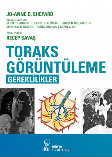 Toraks Görüntüleme: Esaslar