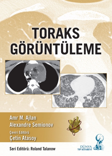 Toraks Görüntüleme