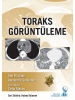 Toraks Görüntüleme