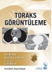 Toraks Görüntüleme