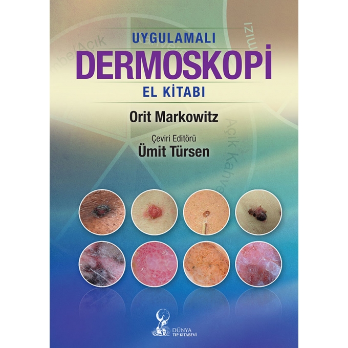 Uygulamalı Dermoskopi El Kitabı