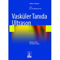 Vasküler Tanıda Ultrason