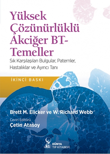 Yüksek Çözünürlüklü Akciğer BT-Temeller (2. Baskı)