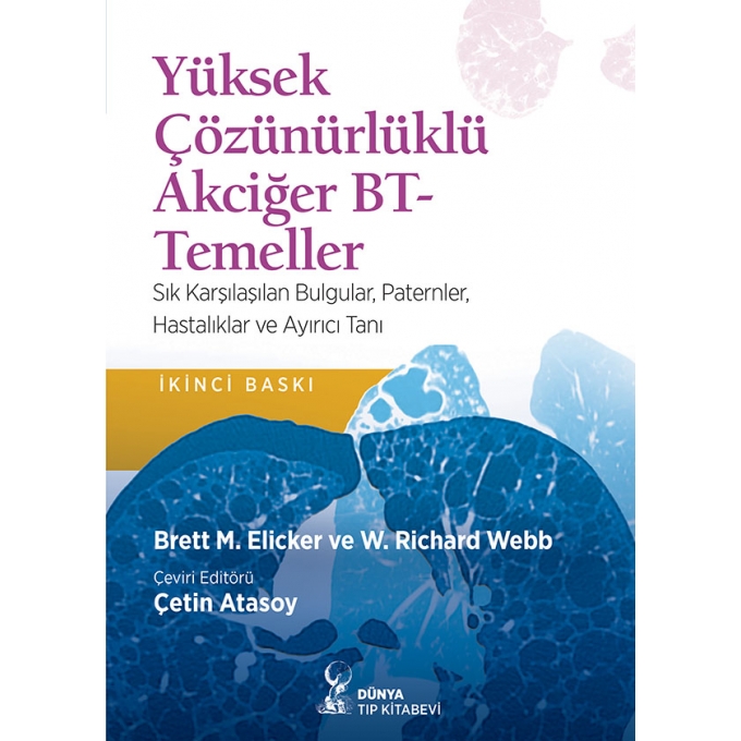 Yüksek Çözünürlüklü Akciğer BT-Temeller (2. Baskı)